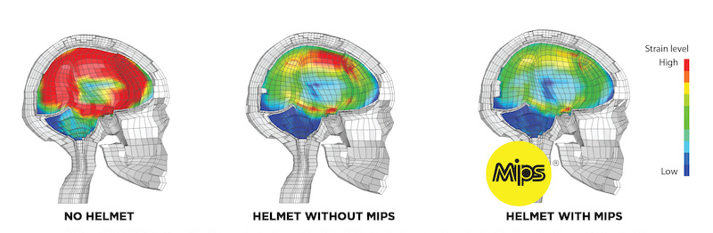 Mips system